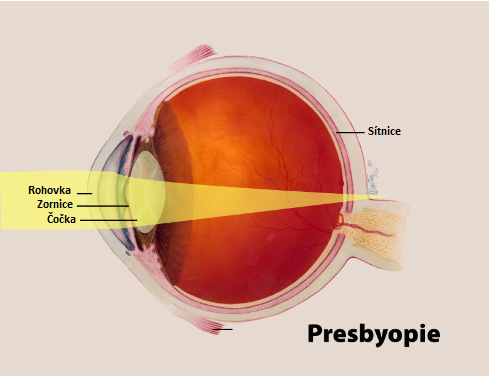 Optika Vaněčková - Presbyopie